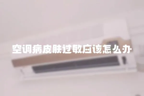 空調病皮膚過敏應該怎么辦